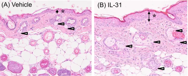 Figure 7  IL-31 投与マウスの皮膚の組織学的解析 