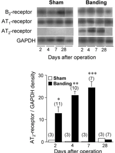 Fig. 2. The mRNA Levels of AT 1 , AT 2 , and B 2 Receptors in the Thoracic Aortas of Mice after Sham-Operation and  Aor-tic Banding