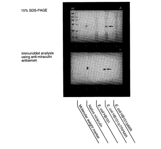 Fig. 5. Analysュs Of the induced protein in the transformants containlng the expression
