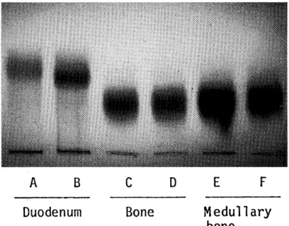 Fig 1 shows the comparison of the zymograms of AP isozymes in duodenum, bone and medullary bone in laying hen between isozyme types.