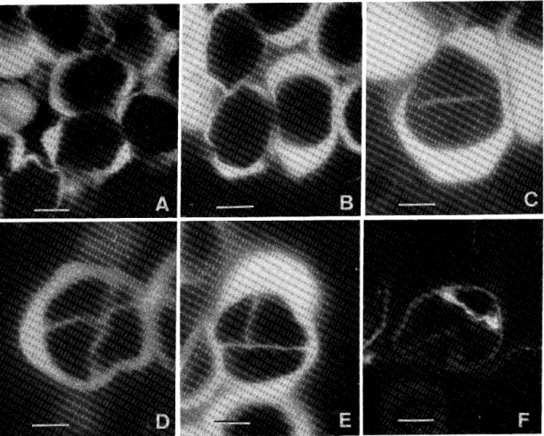 Fig. 5. Deposition of callose during microsporogenesis in Scilla scilloides.