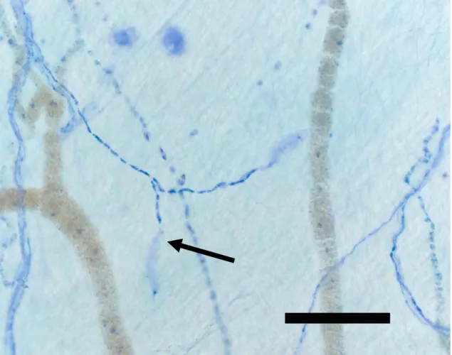 図 6  オトガイ神経切断後 4 週齢の Encapsulated corpuscles（矢印） 
