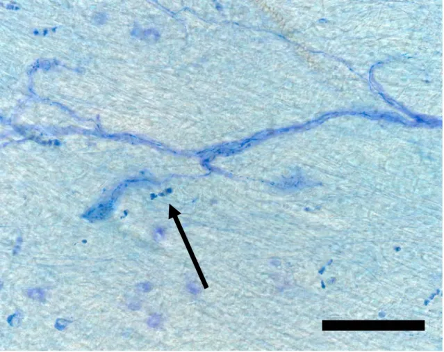図 7   オトガイ神経切断後 20 週齢の Encapsulated corpuscles （矢印）