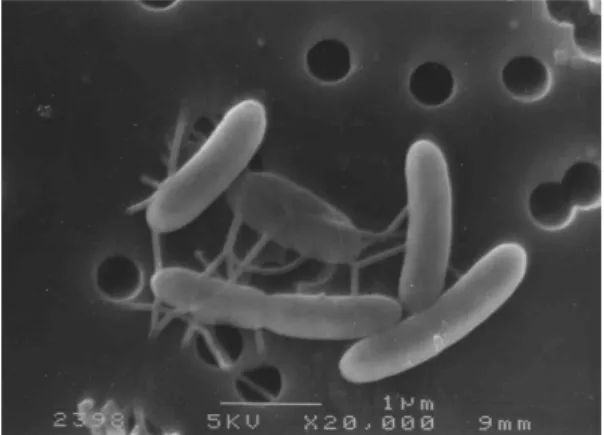 図 2 ． Desulfi tobacterium sp. KBC1 株の電子顕微鏡 (SEM) 写真。