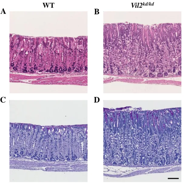 Fig. 13 Vil2 kd/kd マウスの胃体部における胃粘膜の肥厚と腺窩上皮の過形成