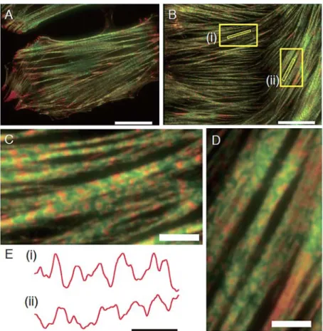 Fig. 2   Characterization of sarcomere-like structures in SFs.（A, B）: SFs in cells（A）and de-roofed cells（B）were dual-labeled  with actin-binding phalloidin（green）and anti- α -actinin（red）.（C, D）: Some SFs displayed relatively regular striations  along the 