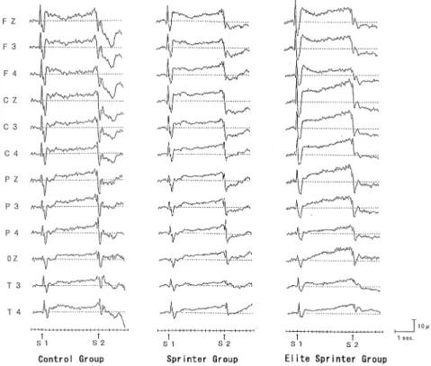 Fig. 4. Mean CNV amplitudes ( μ v) of the early component of each groupFig. 3. CNV grand average waveforms at 12 electrode sites of each group