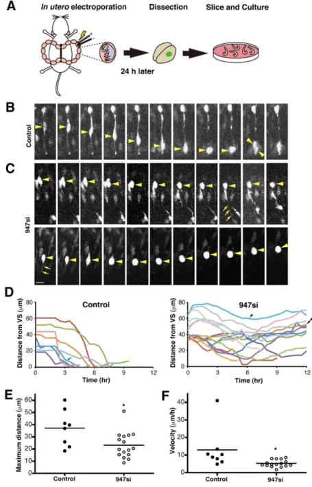 Fig. 4B). These data suggest that microtubule nucleation is impaired in the Pax6 deficient condition.