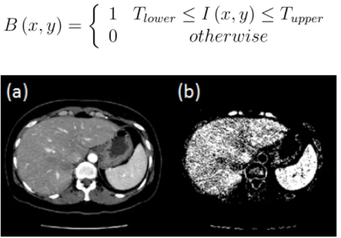 Figure 2.1: Segmentation results of one slice from an abdominal CT scan using the thresholding method