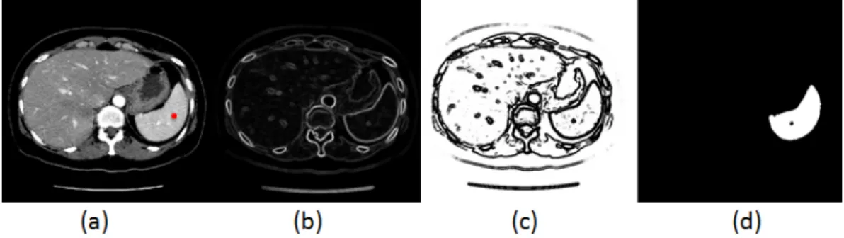 Figure 2.6: Segmentation process based on the shape detection level set method.