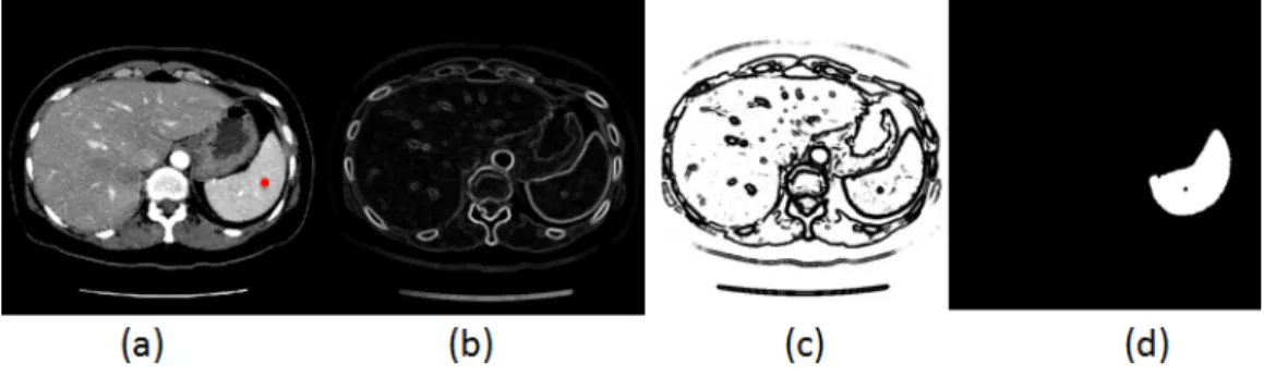 Figure 2.7: Segmentation process based on the GAC method.