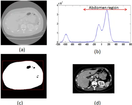 Figure 3.4: Extraction of the abdominal region from the raw CT data. (a) One slice of the raw CT data; (b) Intensity variations; (c) The bounding box of the abdomen; (d) Extraction of the abdominal region.