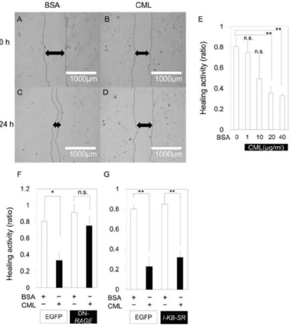 Fig 3-5. RAGE-mediated repressed mobility of mesenchymal cells by CML 