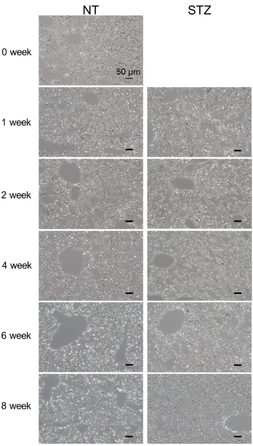Figure 5 Hepatic lipid accumulation of STZ- and NT- mouse was evaluated by Oil red O  stains
