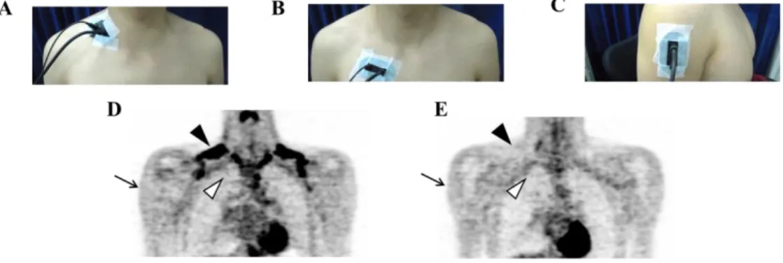 Figure 2. (A–C) The near-infrared time-resolved spectroscopy (NIR TRS ) probe was placed 