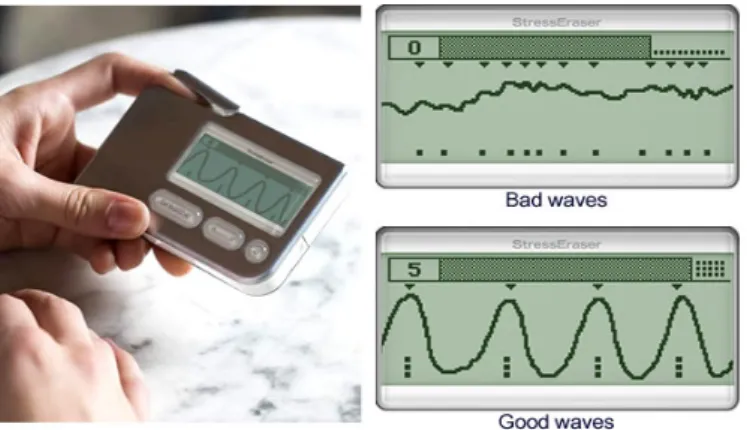 Figure 9. Stress Eraser and the examples of bad waves and good waves. 