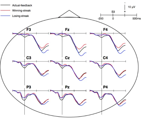 Figure 15. FB-P3 波形