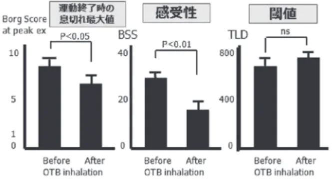 表 2  Quantitative dyspnea indices during exercise before  and after bullectomy