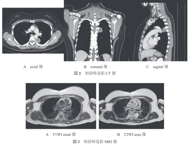 図 1 初診時単純 X 線正面像