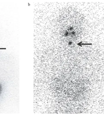 Fig. 2.  Failure case (Case 48 in Table 1)