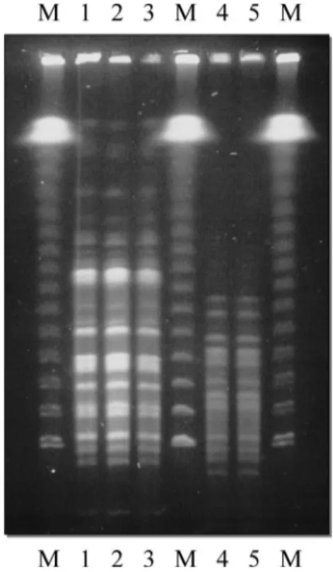 Fig. 1.  Pulsed-field gel electrophoresis  (PFGE) patterns of  Haemophilus  in-ÀXHQ]DH and Streptococcus pneumoniae  chromosomal DNA isolated from the  patient, digested with SmaI restriction  enzyme.