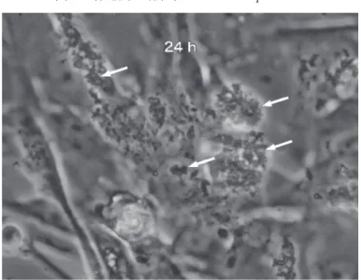 図 2. 線毛間で増殖する Bordetella pertussis