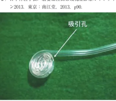 図 一般的な唾液持続吸引チューブ 図 アモレ唾液ケアチューブ（トクソー技研） 重管構造となっているため，口腔粘膜に吸着しにくく，傷つけにく い．また，吸引孔が ヶ所あるので唾液が詰まりにくい．［最近のトピックス］口腔粘膜を傷つけにくい唾液吸引チューブの紹介廣瀬 知二伊東歯科口腔病院ALS（筋萎縮性側索硬化症）は，いくつか病型があるだけでなく，症状の個人差が大きい．しかし，いずれの型であっても嚥下障害が現れ，進行すると自身の唾液を飲み込むことも困難となり，誤嚥から肺炎へつながる可能性が高くなる（高橋ら，）．ま