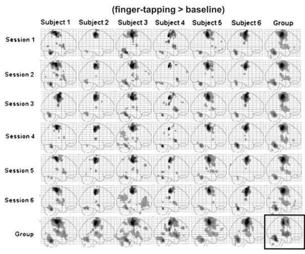 図 5 指タッピング時の MIP 画像 (Kong J et al. Neuroimage 2007)
