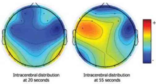 Fig. 6 Intracerebral distribution at 20 and 55 seconds.