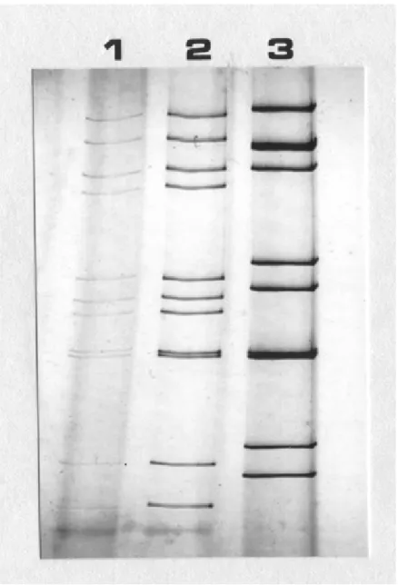 図 1-3 ロタウイルス二本鎖 RNA の PAGE 移動パターンの比較。