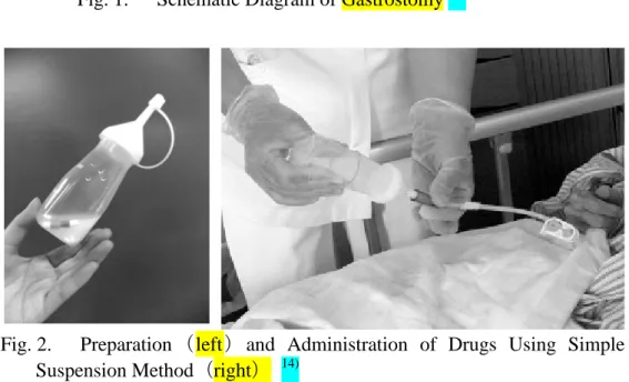Fig. 2.    Preparation （left ） and Administration of Drugs Using Simple  Suspension Method（right）  14)