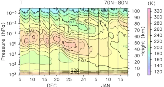 Figure 1    Time-height sections of zonal and 70°N – 80°N regional mean temperature. The  vertical lines represent the boundaries of the model runs