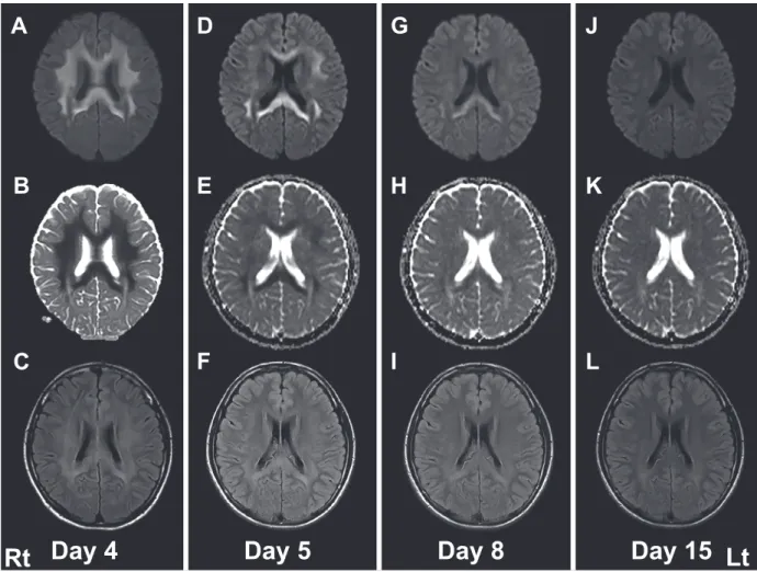 Fig. 2 Clinical course of Brain MRI.