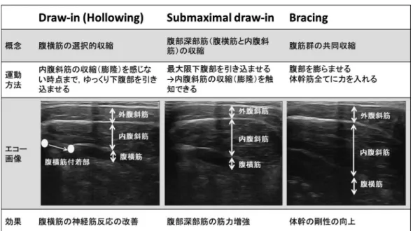 図 2 Draw-in（A）と side draw-in（B）