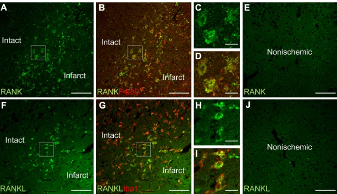 Fig. 1 Expression of RANK (receptor activator of nuclear factor-κB) or RANKL (receptor activator of NF-κB ligand) in the ischemic brain at  48 h after middle cerebral artery occlusion in mice.