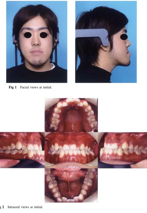 Fig 2 Intraoral views at initial.