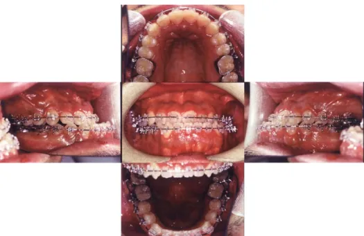 Fig 9 Panoramic tomography at pre-operation.