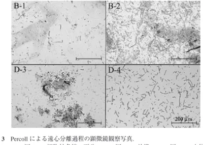 Fig. 2.    Each step of Percoll centrifugation to purify cells from N. commune colony.