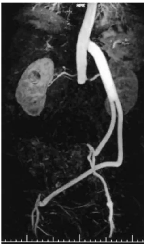 Fig. 1 Postoperative magnetic resonance angiography.