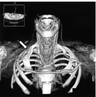 Fig. 2 Postoperative computed tomography scan.