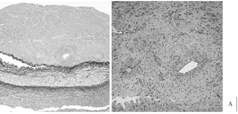 Fig. 5 Plethysmography (1st finger).
