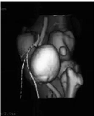 Fig. 1 Contrast computed tomography/3D computed tomography.