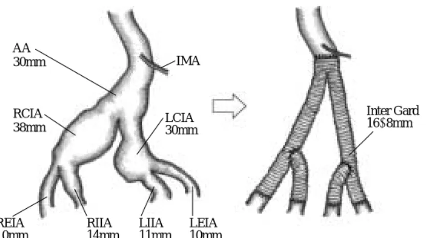 Fig. 3 Operative findings.