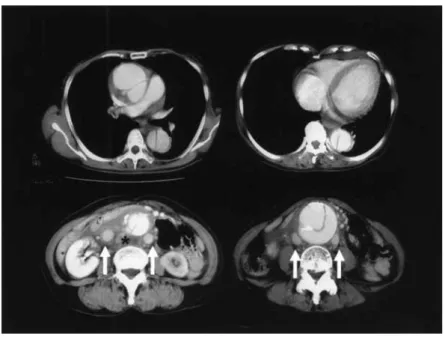 Fig. 2 Operative finding.