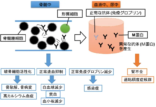 Fig. 1. Pathology of multiple myeloma 