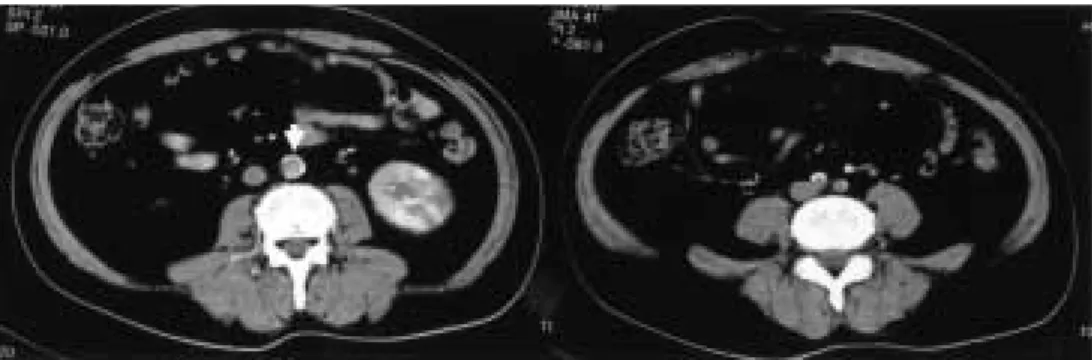 Fig. 1 Preoperative CT scans (Case 1)