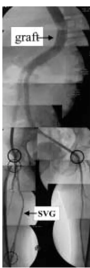Fig. 4 Post-operative angiography