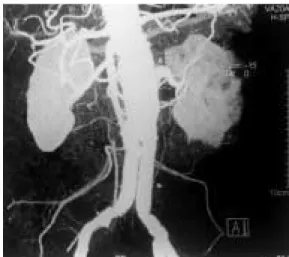 Fig. 5 Post operative aortography