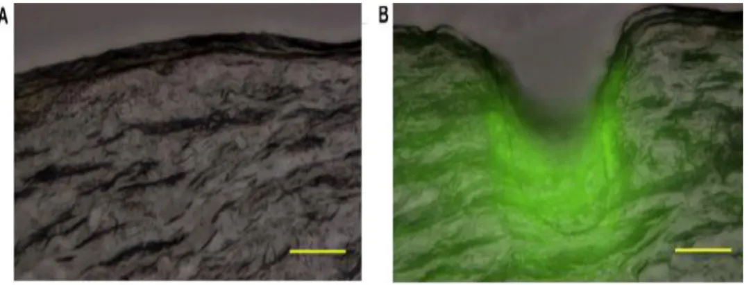 Fig. 5 demonstrates the bright micrographs of MNs before and after their application onto  rat  skin  in  vivo  at  5  min,  30  min,  1  h,  2  h  and  7  h
