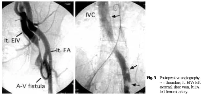 Fig. 5 Postoperative angiography.